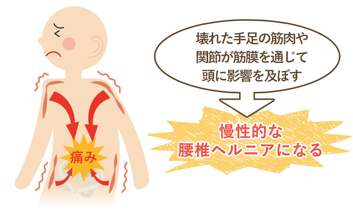 この期間が長く続く程、筋肉などの軟部組織にカルシウム沈着や癒着がおこり慢性的な腰椎ヘルニアになってしまいます。